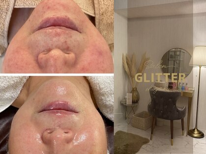 サロン グリッター 新宿(Salon GLITTER)の写真