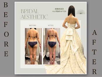 トランジット(transit)/ブライダル/before after