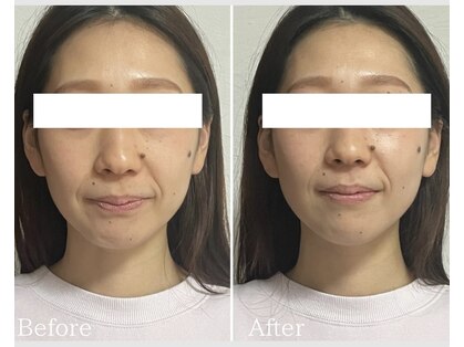 リタ(Rita.)の写真