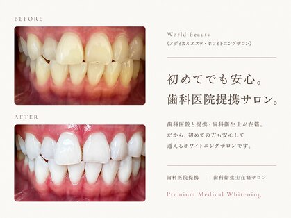 ワールドビューティー(World Beauty)の写真