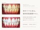 ワールドビューティー(World Beauty)の写真