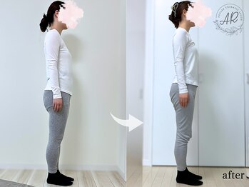 エーアール 白金高輪(AR)の写真/\女性専用・骨を整えるから効果が違う!/肩こり・腰痛・スタイル改善★カラダのお悩みお任せください♪
