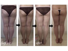 美人バスト 渋谷店/【痩身・ダイエット】 渋谷/脚☆