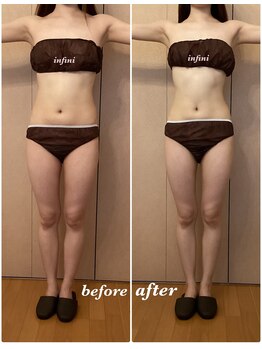 アンフィニ(infini)/短期集中コース5回目(1ヶ月)