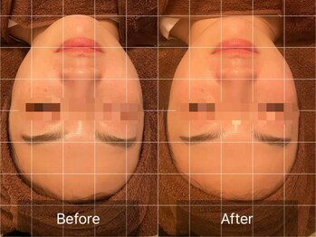 整顔整頭/小顔ケア