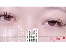 ムニ(muni)/アップワードラッシュ