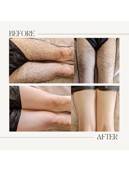 スプランドゥール(Splendeur)/メンズ【膝上】WAX+光