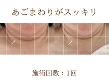 アンスリウム(ansrium)/