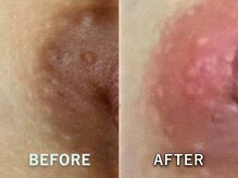 ドアディ(Doordie)/ローマピンク