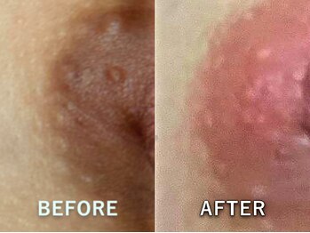 ドアディ(Doordie)/ローマピンク