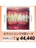 【メンテナンス向け】☆高濃度ジェル採用☆ホワイトニング9回コース¥44,440