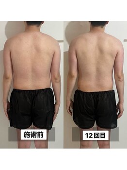 インナーメス(INNER MES)/【痩身】上半身コース