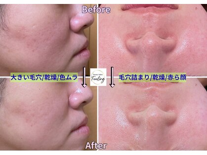 フィーリング(Feeling)の写真