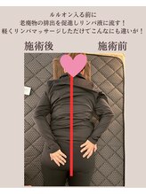 ヨサパーク ハロ(YOSA PARK Haro)/