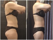 美容整体 ウェリナ 蟹江院/小顔矯正/骨盤矯正/美脚サロン 