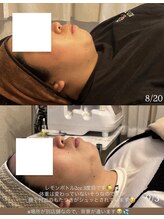 モア(more.)/コルギ×レモンボトル