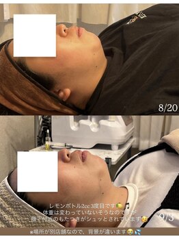 モア(more.)/コルギ×レモンボトル