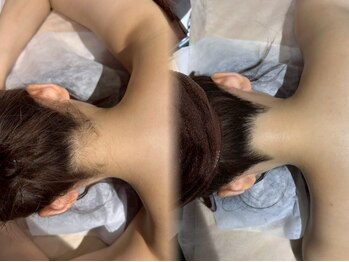 グラスト(Grast)の写真/肌タイプ｜毛質に合わせた施術が大好評★★暖かいベッドで施術中も快適♪