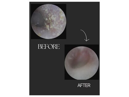 ベル(Bell)の写真