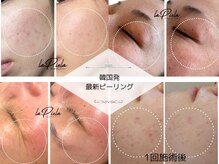 ケイ ティ レディース