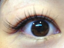 アイエステ(Ai esthe)