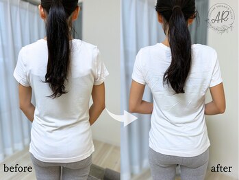 エーアール(AR)/【Before/After】　