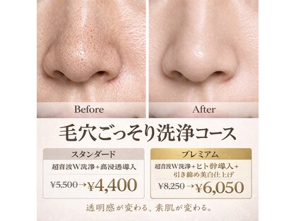 ちゅるん肌ドットコム 喜連瓜破店(ちゅるん肌.com)の写真