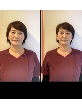 味岡整骨院/小顔矯正！スタッフもお試し♪