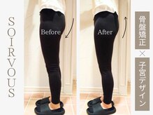 美子宮骨盤彫調整術☆たった1回の施術で美脚&美尻ヒップアップ♪