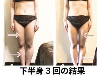 ニュートラル 池袋店(NEUTRAL)/施術結果【痩身/筋膜】