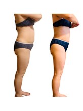 ソフィアアイズ 倉敷店(SOPHIAEYES)/ハイパーナイフ７での効果