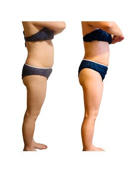 ソフィアアイズ 倉敷店(SOPHIAEYES)/ハイパーナイフ７での効果