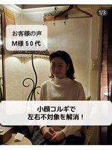 ケーズハート(K's heart)/顔の左右不対象が解消されました