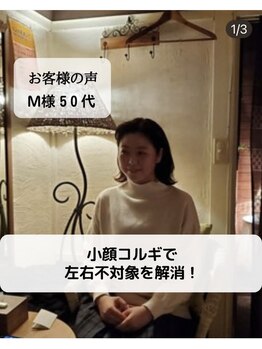 ケーズハート(K's heart)/顔の左右不対象が解消されました