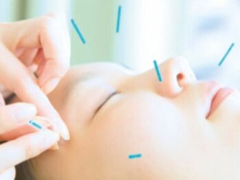 トリアス鍼灸接骨院の写真/【お顔のたるみが気になる方へ♪】お客様から「気持ちよい」の声多数の美容鍼で小顔を目指せる◎