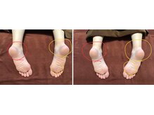 マクシル 札幌店 puls1(MAXIL)/冬になると人気の角質ケア◎