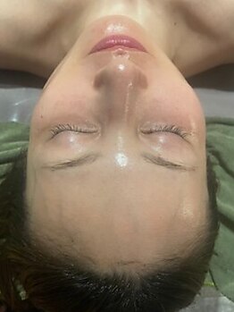 シルグラン(SIL gran)の写真/《医療機関と提携》ダウンタイムのサポートエステサロン◎日常生活に早く戻れるサポートいたします!