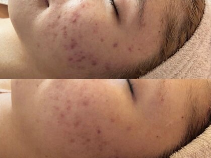 リジェ(Rege)の写真