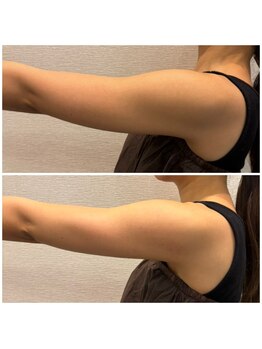 ビュウナ 銀座(BEAUNA)/ブライダル☆セレクトbody