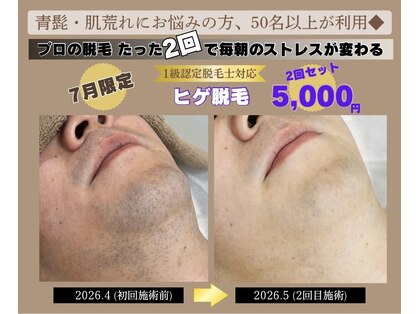 フォー(the 4)の写真
