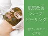 ハーブピーリング【毛穴/ニキビケア/むくみ】クリスティーナ【メンズに人気】