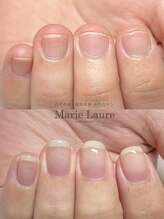 マリーロール 梅田店(Marie Laure)/自爪育成/深爪矯正/ネイルケア
