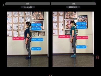 ナオル整体 浅草院(NAORU整体)/40代女性【猫背・巻き肩】