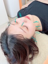 ヒーリングサロン アージュ(A-je)/★美顔鍼＋小顔矯正★