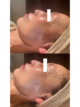 ディオーネ 春日井勝川店(Dione)/マーメイド☆ビフォーアフター