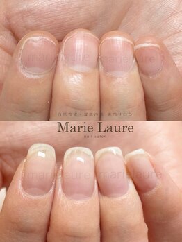 マリーロール 淀屋橋本店(Marie Laure)/自爪育成/深爪矯正/ネイルケア