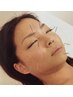 《オーダーメイド鍼灸施術》 美容鍼灸★肌トラブルでお悩みの方に 60分 ¥7500