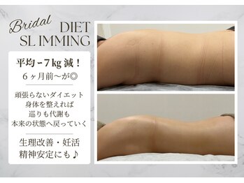 サロンドエリ ラクロワジエール(Salon d’ERI la Croisiere)/【平均7kg減】6ヶ月~痩身◎