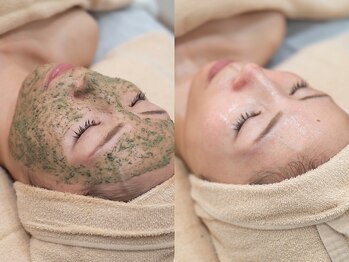 リノン(LINON)の写真/《人気NO,1REVIハーブピーリング》内側から整う褒められる美肌へ