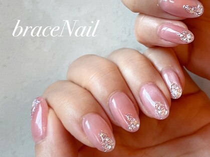 ブレスネイル(brace Nail)の写真